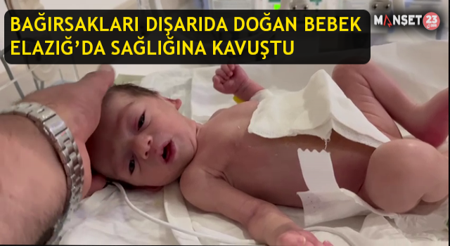 Bağırsakları Dışarıda Doğan Bebek Elazığ’da Sağlığına Kavuştu
