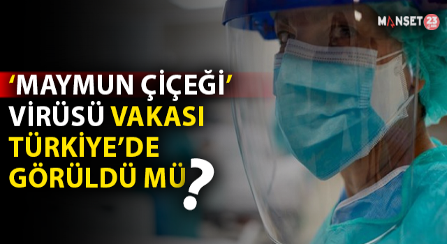 Maymun Çiçeği Virüsü Türkiye'de Görüldü Mü?