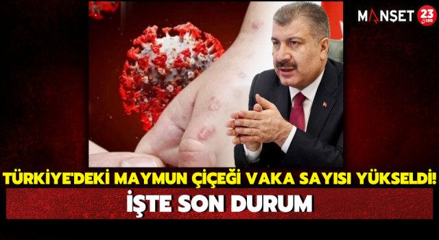 Türkiye'deki Maymun Çiçeği Vaka Sayısı Yükseldi! İşte Son Durum