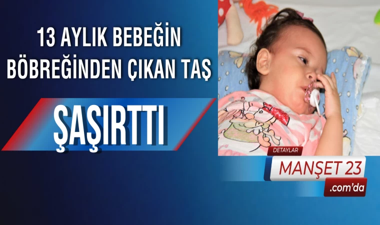 13 Aylık Bebeğin Böbreğinden Çıkan Taş Şaşırttı