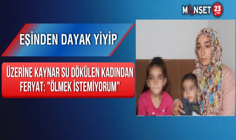 Eşinden Dayak Yiyip Üzerine Kaynar Su dökülen Kadından Feryat: "Ölmek istemiyorum"