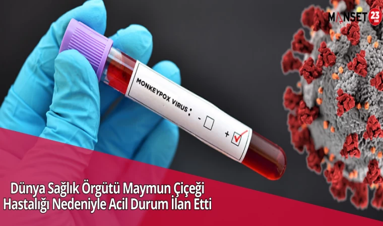 Dünya Sağlık Örgütü Maymun Çiçeği Hastalığı Nedeniyle Acil Durum İlan Etti